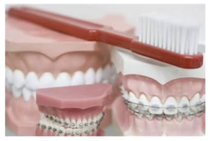 Dental Implants Treatment